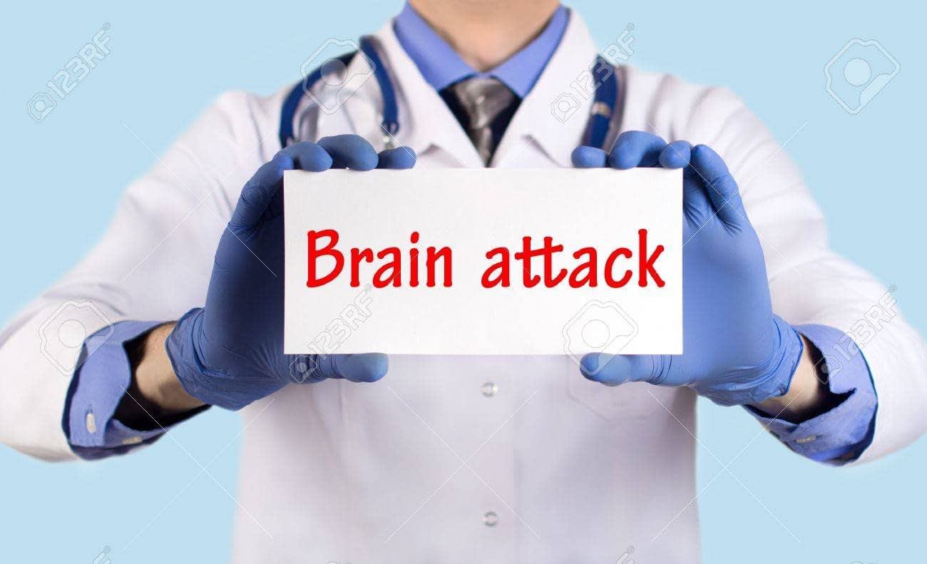 السكتة الدماغية Brain Attack